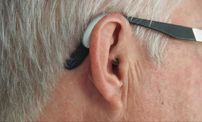 Oticon Hearing Aid Batteries: Ensuring Optimal Performance